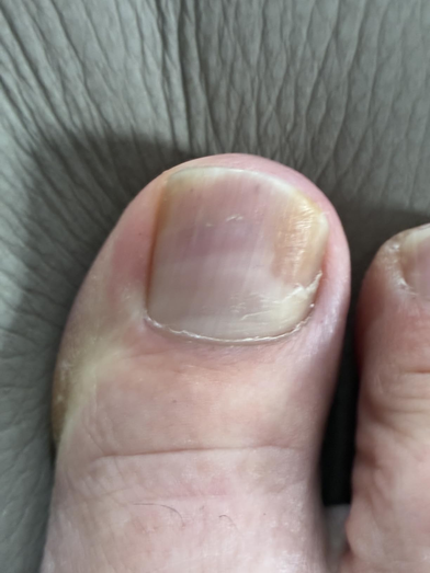 After treatment