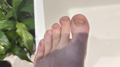 After treatment