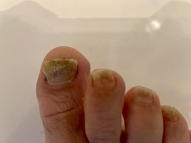 Before treatment