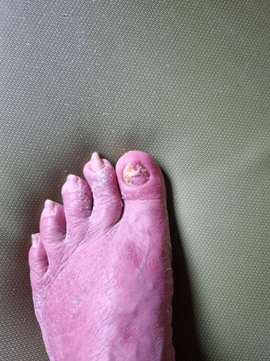 Before treatment